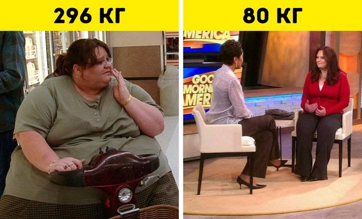 Я вешу 300 кг: что было дальше?
