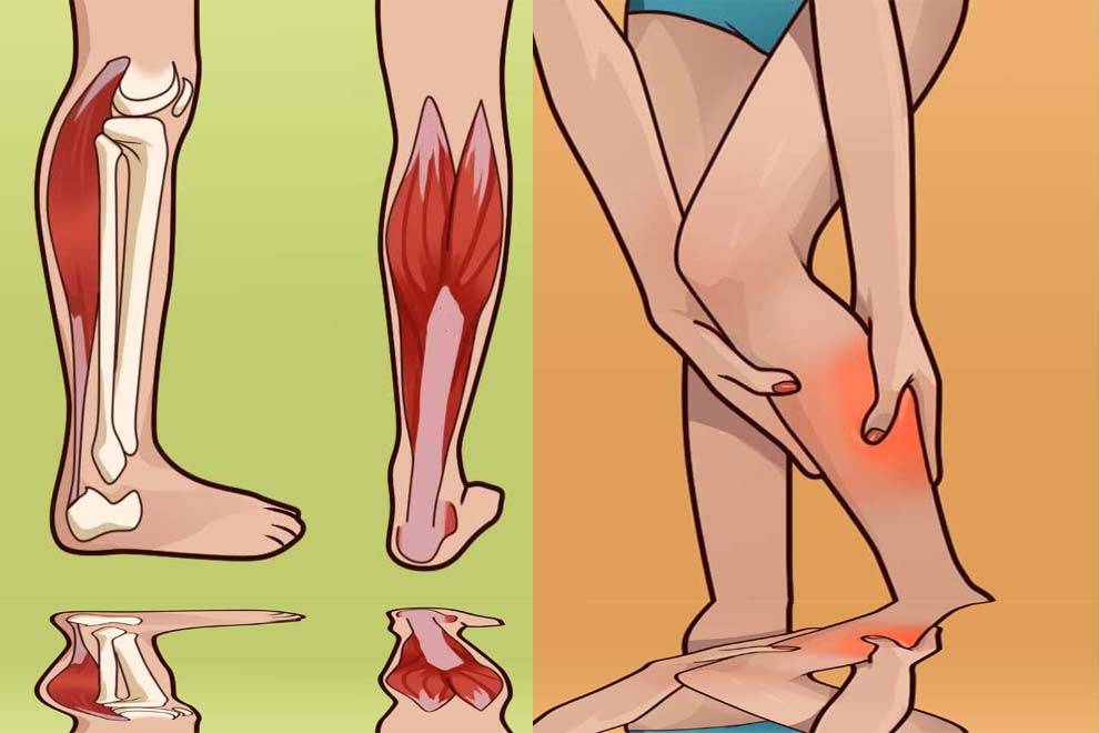 Судороги ног: причины и лечение, что делать, если сводит ноги - напоправку – напоправку