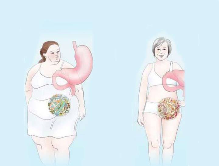 Как уменьшить желудок без операции: диета, упражнения и другие способы уменьшить желудок. какой нормальный объем желудка? причины растяжения желудка. операция по уменьшению желудка: польза и вред