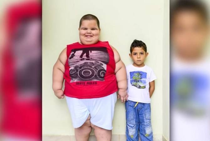 Самые толстые дети в мире - подборка информации с фото