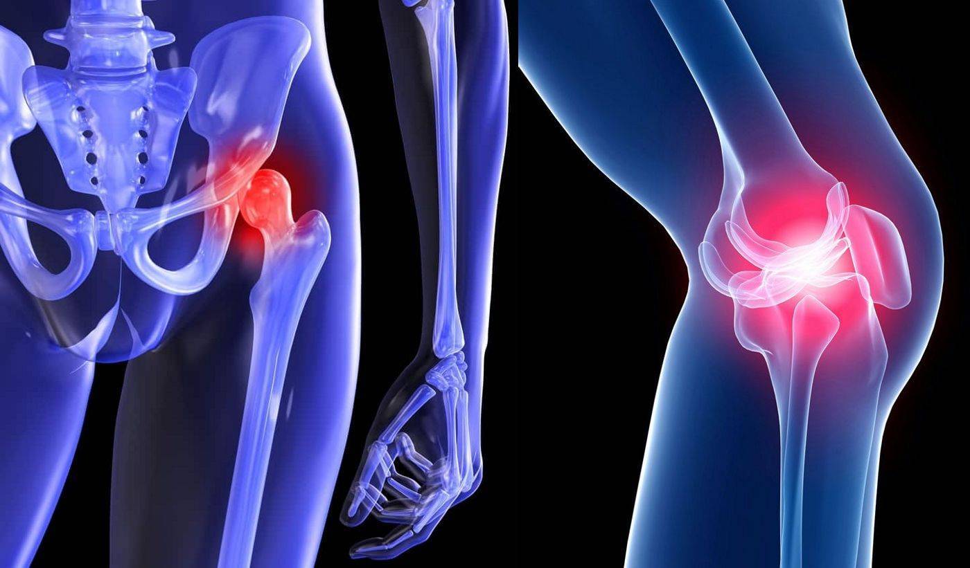5 секретов восстановления хрящевой ткани в колене - нолтрекс.