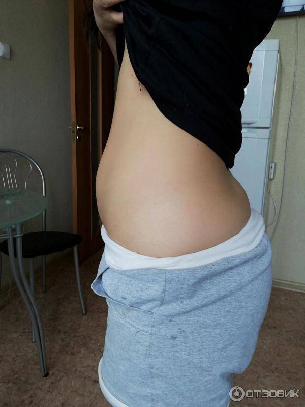 10 причин больших животов (кроме беременности): «сама худая, а живот торчит