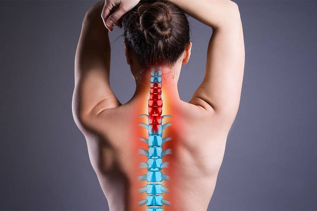 Способы лечения йогой при межпозвоночной грыже, сколиозах и других проблемах позвоночника: забудьте о боли в спине!