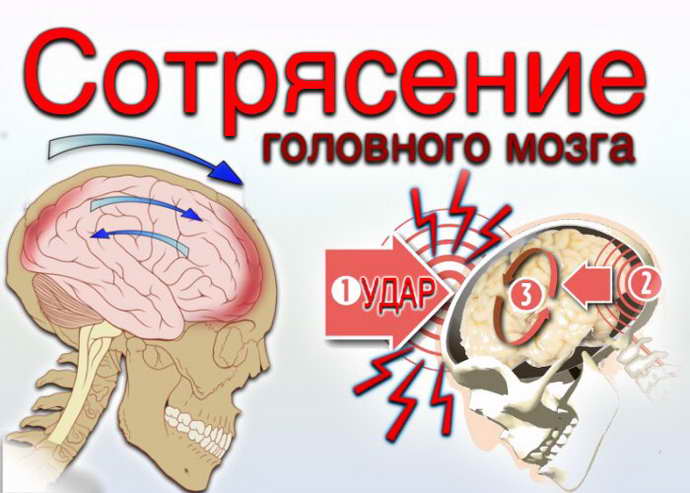 Черепно-мозговые травмы (чмт)