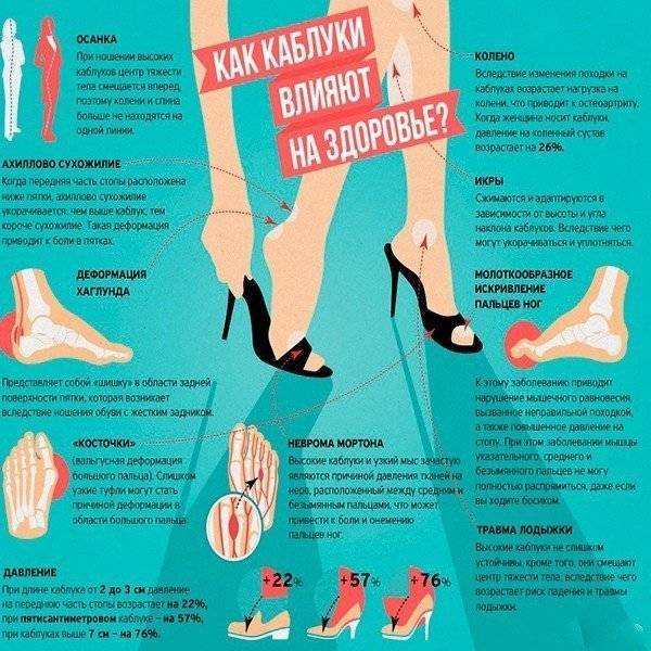 Какой вред наносят каблуки вашему здоровью?