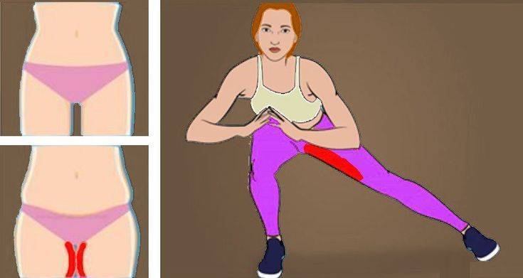 Физические упражнения против целлюлита