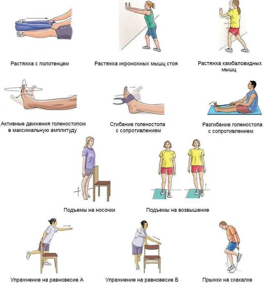 Гонартроз - причины и лечение остеоартроза коленного сустава | medi