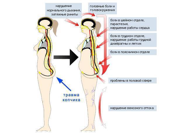 Боль в спине и пояснице: причины и лечение, почему болит спина – напоправку
