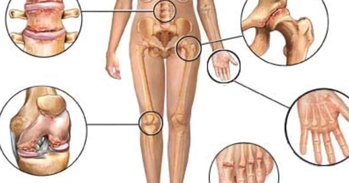 Почему хрустят суставы во всем теле? | "здравствуй"