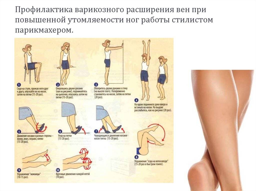 Запреты при варикозе ног (нижних конечностей)