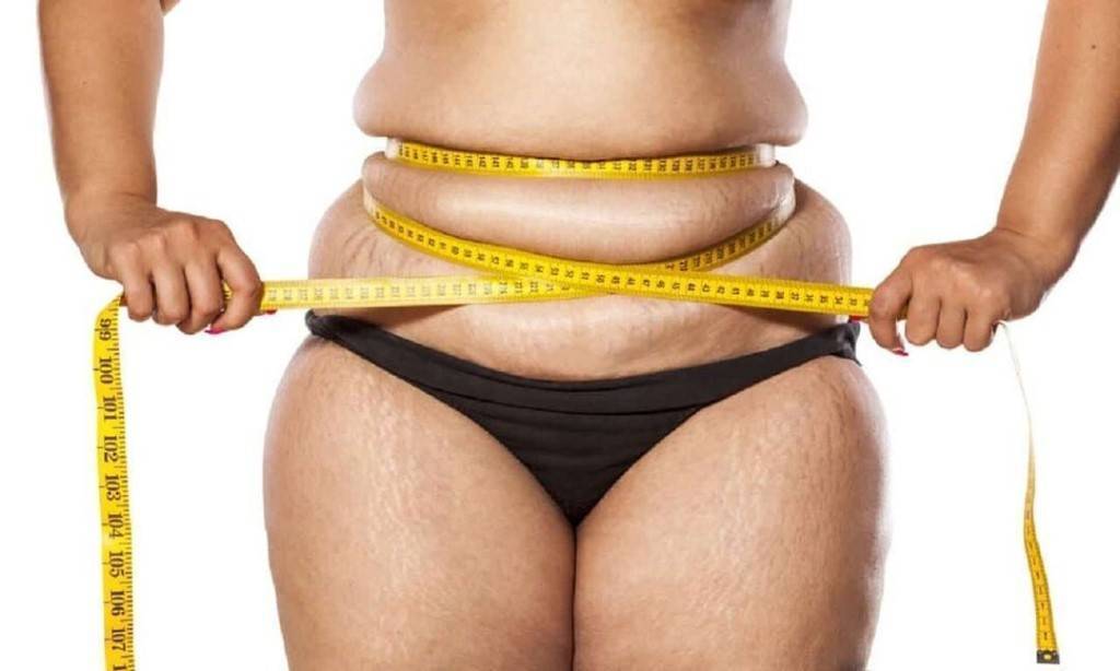 Продольная резекция желудка при ожирении – о чем должен знать пациент
