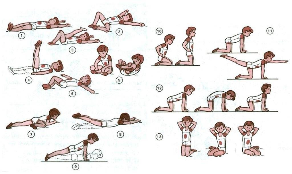 Лечебная физкультура при сколиозе: комплексы упражнений и правила их выполнения