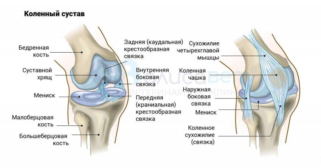 Нестабильность коленного сустава — не приговор! лечение в цэлт.