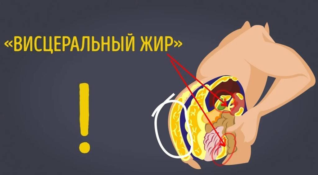 Почему убрать жир локально, можно только при помощи операции  | igor-butko.ru