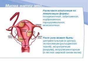 Атрофический вагинит - подробно о лечении атрофического вагинита в постменопаузе у женщин