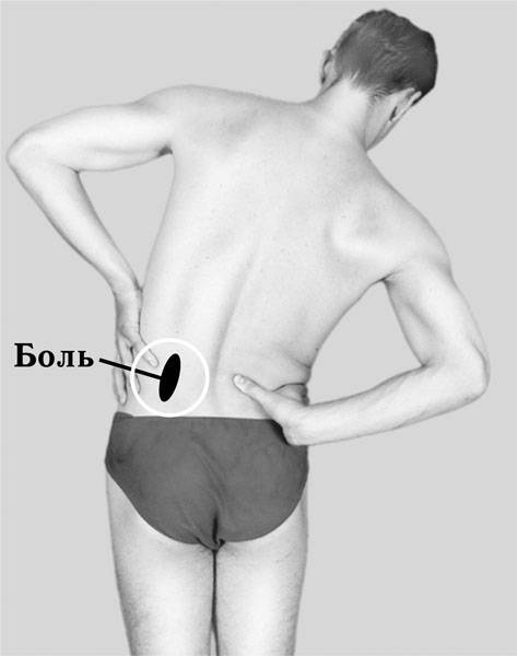 Острая боль в спине: что делать, упражнения | компетентно о здоровье на ilive