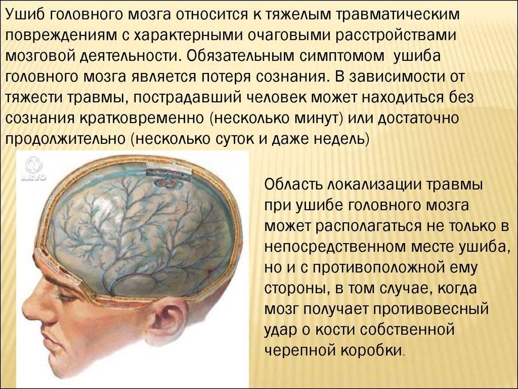 Сотрясение головного мозга – симптомы, признаки, первая помощь, степени повреждения